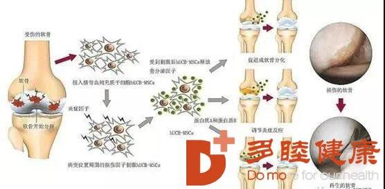 關(guān)節(jié)軟骨再生最新進展與觀點論述揭秘